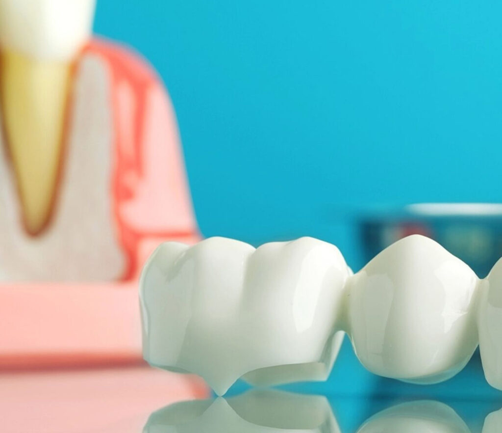 Der Textprofi für Zahnärzte - Texte über Zahnmedizin - Blogbeitrag: Sie benötigen einen Zahnersatz?