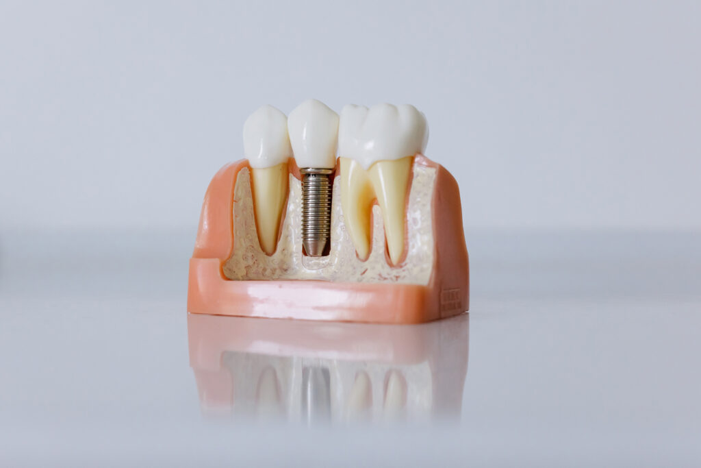 Der Textprofi für Zahnärzte schreibt in ihrem Blog über Zahnmedizin