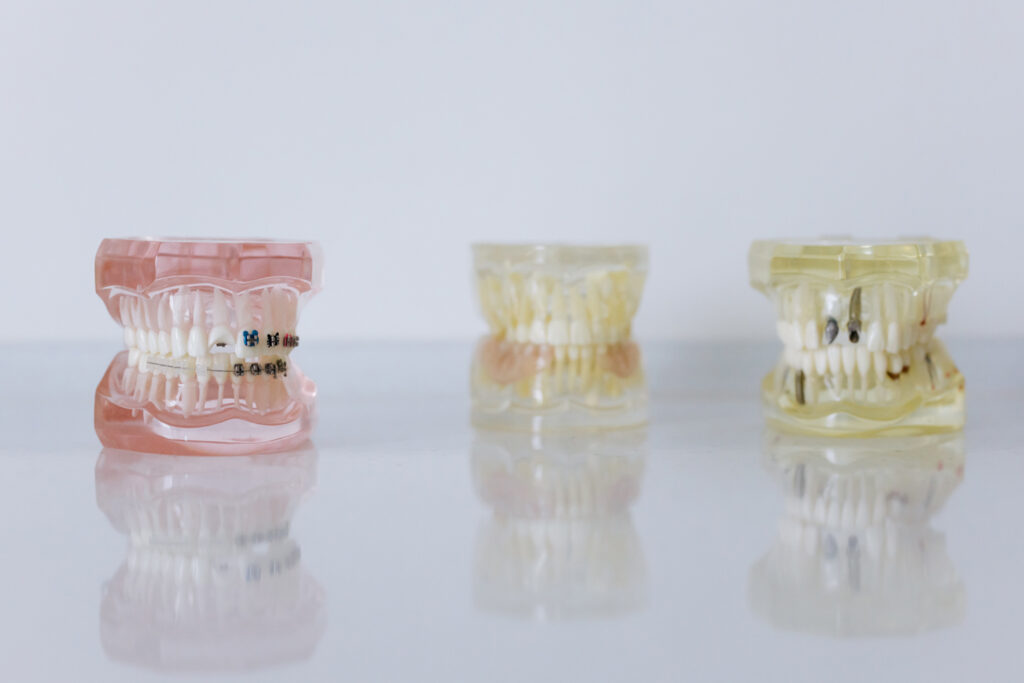 Der Textprofi für Zahnärzte - Texte über Zahnmedizin - Blogbeitrag: Lohnt sich eine Zahnzusatz-Versicherung?